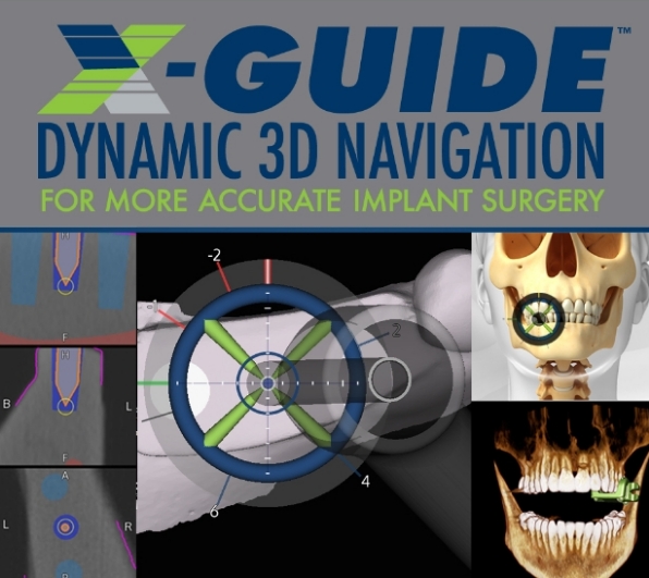 Birmingham’s Top Oral Surgery & Implants Center | Maniscalco - xguide